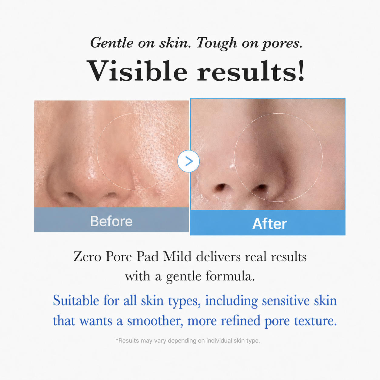 DCARE Pore Refining Pads